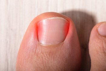 Why Is My Big Toe Suddenly Painful?