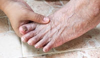 Foot Fungal Infections in the Elderly