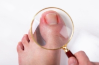 Dealing With Ingrown Toenails