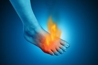 Burning Foot Pain and What It Can Mean