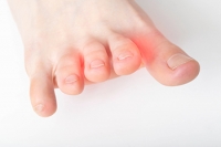 Easing the Pain of Morton’s Neuroma